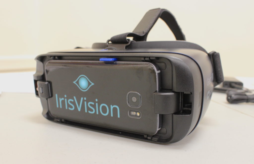 IrisVision