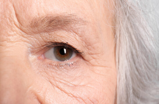 Wrinkled Face Of Elderly Woman